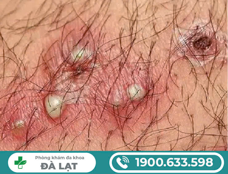 Hình ảnh minh họa